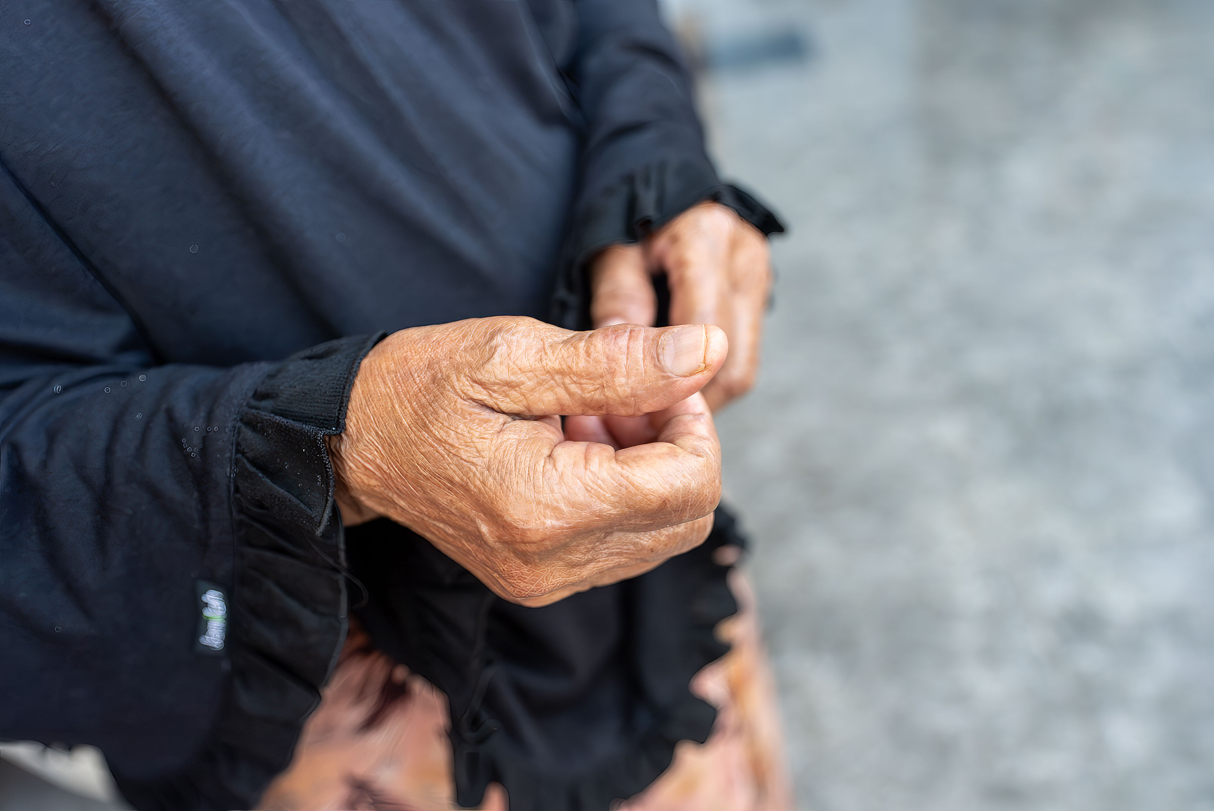Bu Im’s mother, Suharti, still has scarring on her hand from having contracted anthrax back in 2011. 