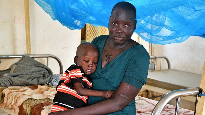 Joska holds her son, Lolimo, in her arms in Kapoeta Civil Hospital, South Sudan, where he's receiving treatment for malnutrition.
