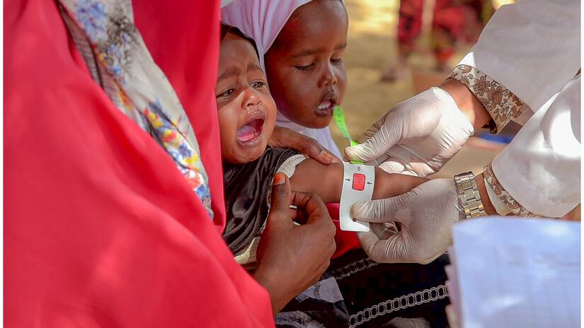 Dalow mobile clinic at Sahil region, Somaliland, 30th June 2021. A 10 month old baby, assessed as severely malnourished.
